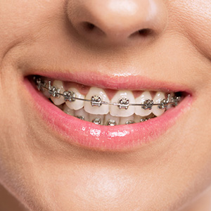 UnderstandingtheAgingProcessLeadstoMoreEffectiveOrthodontics