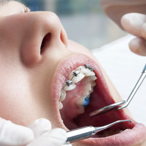 OrthodonticsCouldbetheSmileTransformerYouveBeenLookingFor