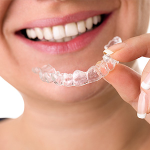 ClearAlignersMakeitEasierforTeenagerstohaveTheirTeethStraightened