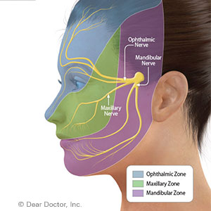 FacialNervePaincanbeManagedwithEffectiveTreatment